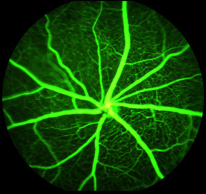PNAS:血管內皮細胞生長因子是傷口愈合的關鍵